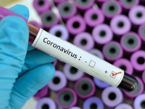 Türkiyədəki vətəndaşlarımız pulsuz koronavirus testindən KEÇƏCƏKLƏR