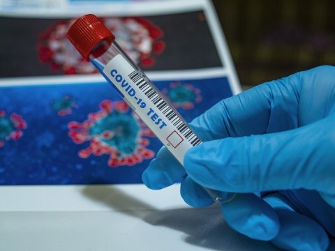 Azərbaycanın bu bölgəsində koronavirusa yoluxanların sayı 96-ya çatdı