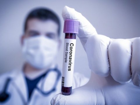 Azərbaycanda sorğu keçirilib: 53,1% virusdan qorxur, 44,9% ona inanmır   