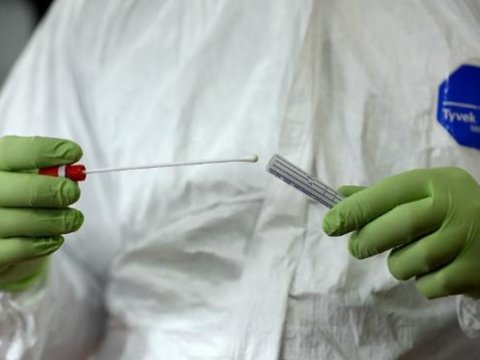 Azərbaycanda neçə koronavirus testi keçirilib?