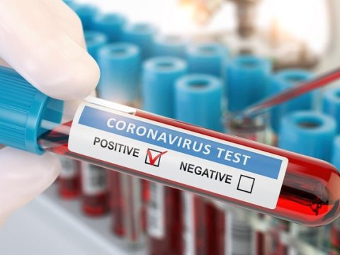 Azərbaycanda indiyədək aparılan koronavirus testlərinin sayı AÇIQLANDI