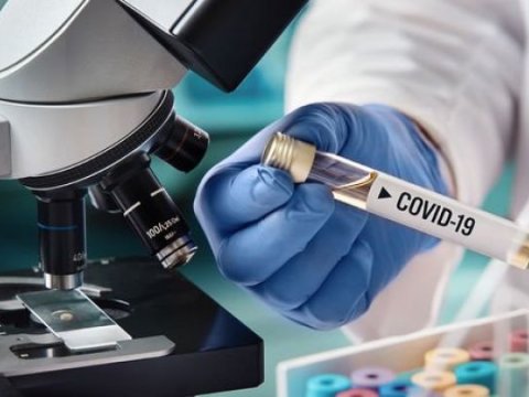 Azərbaycanda daha 523 nəfərdə koronavirus aşkarlandı - 9 nəfər öldü
