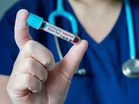 Azərbaycanda virusa yoluxanların yaş göstəriciləri ilə bağlı son RƏQƏMLƏR