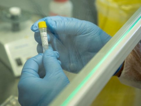 Ermənistanda koronavirusa yoluxanların və ölənlərin sayı ARTDI