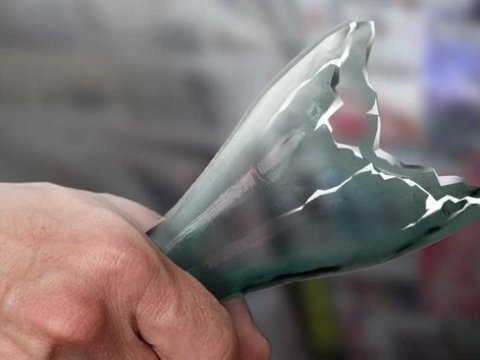 28 yaşlı kişi keçmiş arvadının boğazını kəsdi