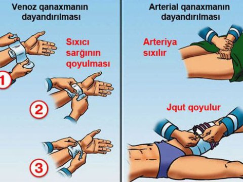 QANAXMALARI NECƏ DAYANDIRMAQ OLAR?