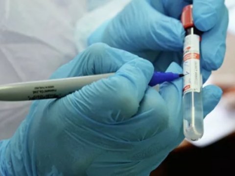 Britaniyada koronavirusla bağlı son durum