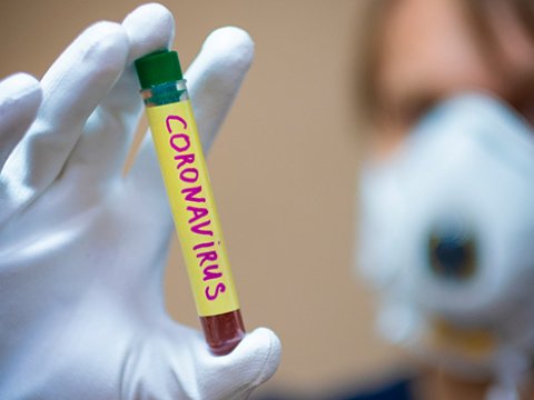 Ermənistanda COVID-19-a yoluxanların və ölənlərin sayı ARTIB