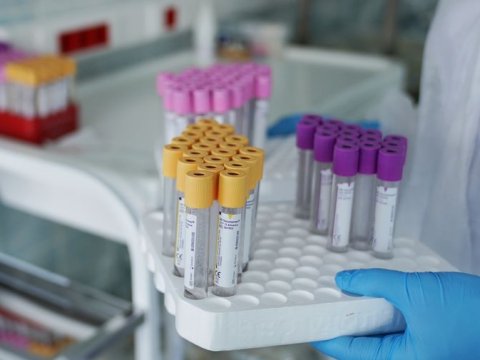 Gürcüstanda aktiv viruslu xəstələrin sayı 268-ə çatdı