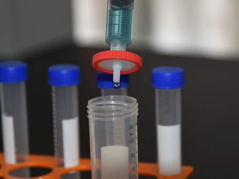 Koronavirus əleyhinə zərdab ixtira edildi