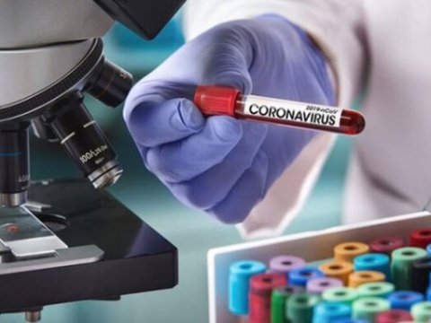 Reanimasiyadakı COVİD-19 xəstələrinin sayı AÇIQLANDI