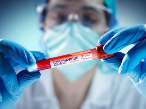 Dünyada koronavirusa yoluxanların sayı artıb