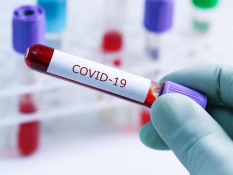 Bu günün statistikası: 193 yoluxma, 492 sağalma, 3 ölüm