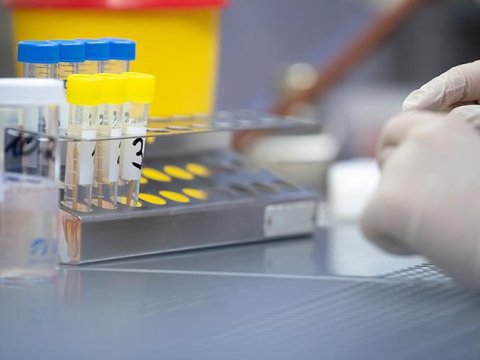 Türkiyədə 9 deputat koronavirusa yoluxub