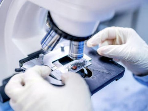 Azərbaycanda insanlar seroloji testlərdən keçəcəklər