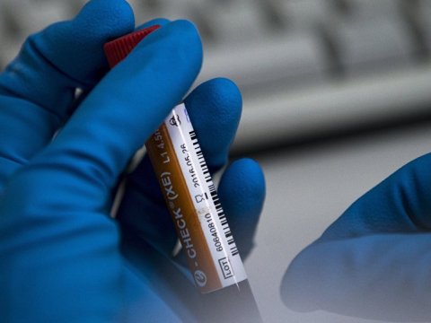 İki idmançımız dopinqə görə cəzalandırldı
