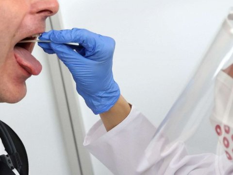 ABŞ-da nümunəsi 10 dollara olan koronavirus testi hazırlanıb 