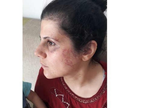 “Yalvarıram, mənə kömək edin!” - Aldadılıb Türkiyəyə aparılan azərbaycanlı qadının FƏRYADI
