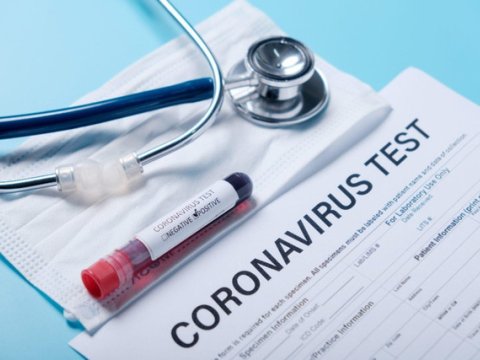 TƏBİB koronavirus testindən keçmək üçün vətəndaşlara zəng vurur 