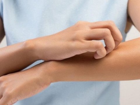 Qaşınma xərçəngin bu növlərinin göstəricisi ola bilər