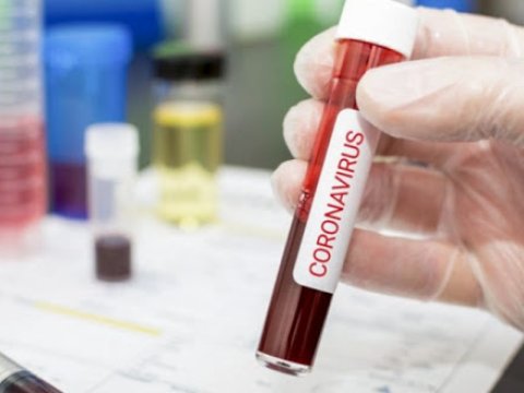 Koronavirusa yoluxan 79 nəfər donor olub