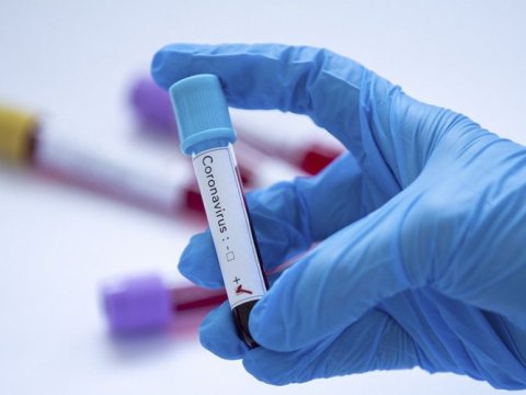 Azərbaycanda 40 jurnalist koronavirusa yoluxub - onlardan 5-i vəfat edib