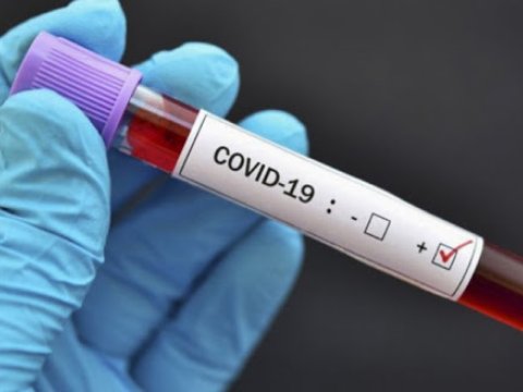 Dünyada koronavirusdan ölənlərin sayı 879 min nəfəri ötdü  