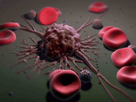 Alimlər xərçəng xəstəliyinin metastazına üstün gəlmək üsulunu tapdılar