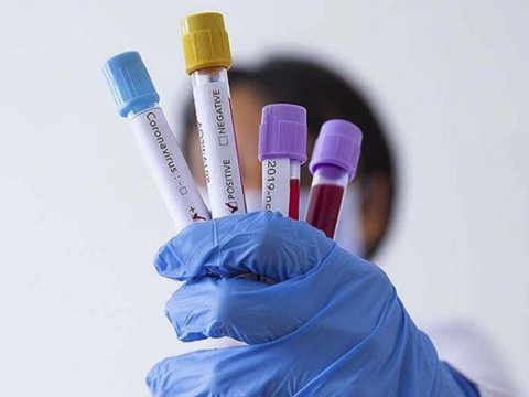 Gürcüstanda və Ermənistanda da koronaviruslu xəstələrin sayı artıb