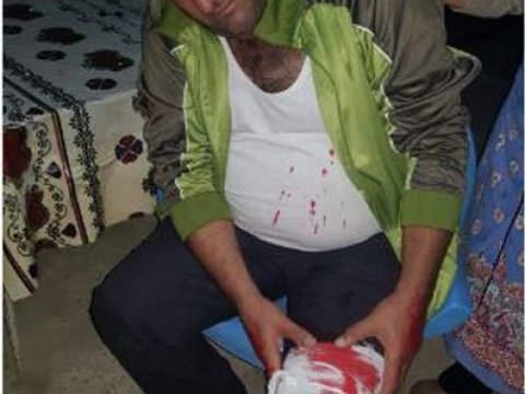 Ermənilərin yaraladığı mülki vətəndaşımızın FOTOSU