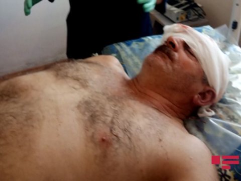 Ermənilərin yaraladığı mülki şəxs xəstəxanaya yerləşdirildi