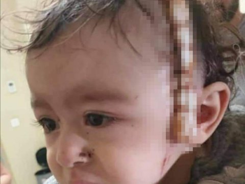 Prezidentin köməkçisi Gəncədə yaralanan 10 aylıq Zəhranın fotosunu paylaşdı