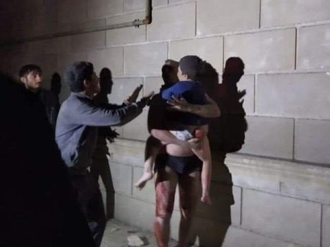 Ermənilər Gəncəni atəşə tutdular - uşaqlar yaralandı - FOTOLAR