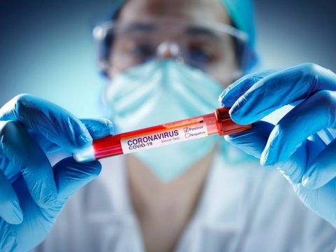 Azərbaycanda 122 nəfər koronavirusa yoluxdu - Yeni statistika
