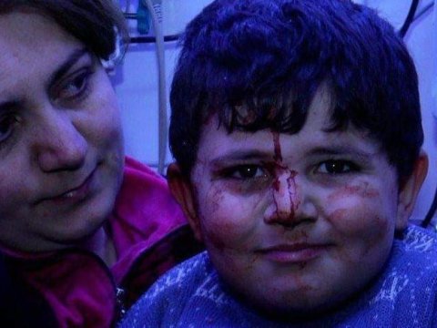 Balaca Bəxtiyarın erməni xisləti üzərində təntənəsi - VİDEO  