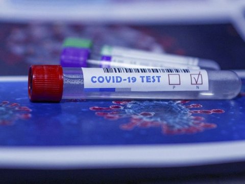 Azərbaycanda indiyədək bu qədər koronavirus testi aparılıb