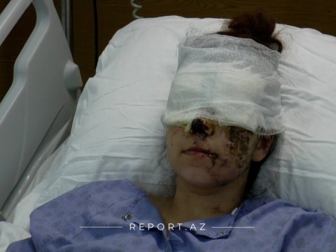 Ermənilərin Gəncə terroru iki uşaq anasını görmə qabiliyyətindən məhrum etdi