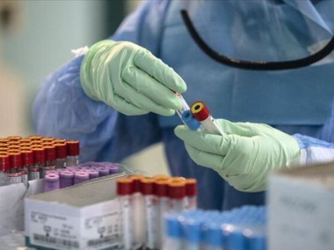Bakıda koronavirusun ən çox yayıldığı RAYONLAR  