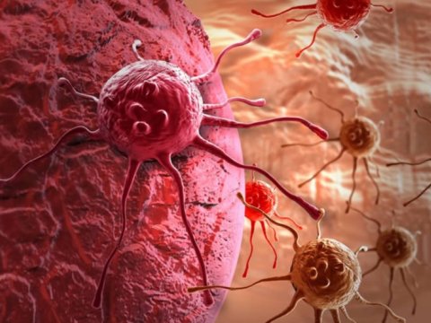 Xərçəngin yaranma riskini artıran məhsulların adları açıqlandı