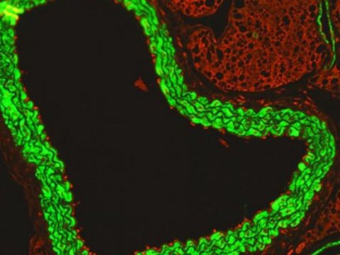 Alimlər bu virusunun siçanlardan insana keçməsini qeydə aldılar