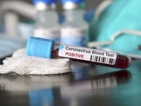 Azərbaycanda indiyədək aparılmış koronavirus testlərinin sayı açıqlandı