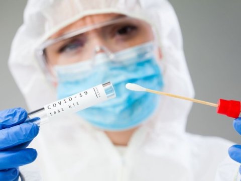 Azərbaycanda COVİD-19 testləri bitib?