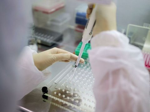 Dünyanın dəhşətli koronavirus STATİSTİKASI