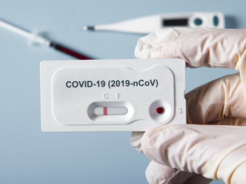 Deputatdan təklif: “Koronavirus testlərinin qiyməti aşağı salınmalıdır”