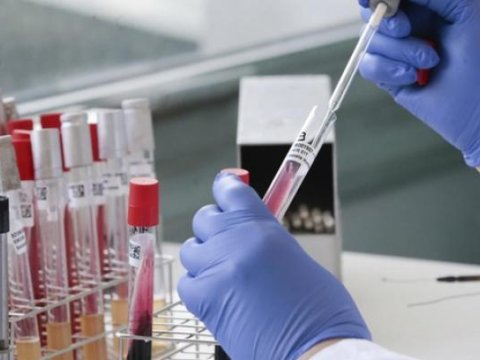 Koronavirusdan sağalan şəxsin 14 gün sonra test verməsinə ehtiyac yoxdur - Nazirlik