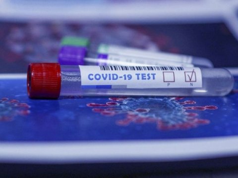 Rusiyada koronavirusdan ölənlərin sayı 58 mini ötüb