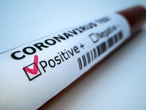 Koronavirusdan ölən jurnalistlərin sayı açıqlandı