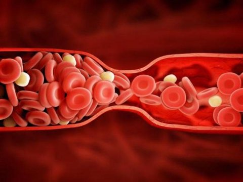 Xərçəngin yeni əlaməti açıqlandı