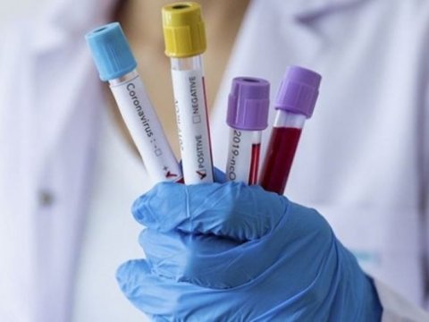 Koronavirus peyvəndi ilk dəfə uşaqlar üzərində sınanacaq