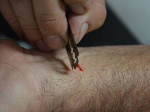 Bakıda dustaqlar məhkəmə zalında özlərini ülgüclə DOĞRADILAR